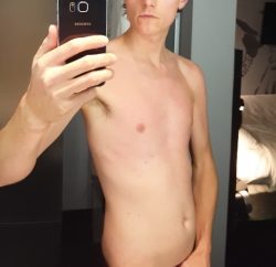 Connor D (twinkboyfacial) Leaked Photos and Videos